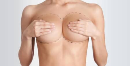 Breast Reduction Surgery in Delhi