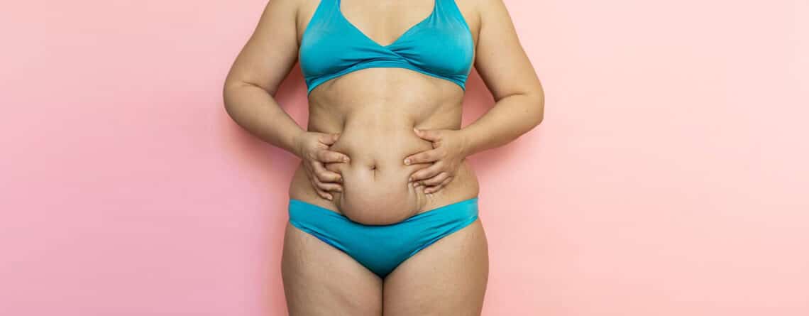 Tummy tuck procedure