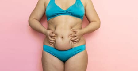 Tummy tuck procedure