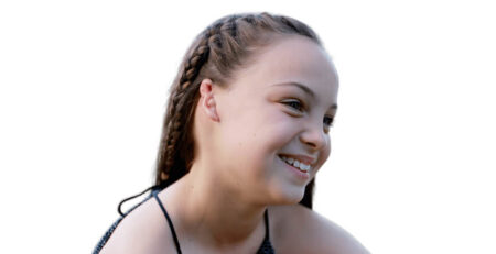 Microtia surgery in Delhi