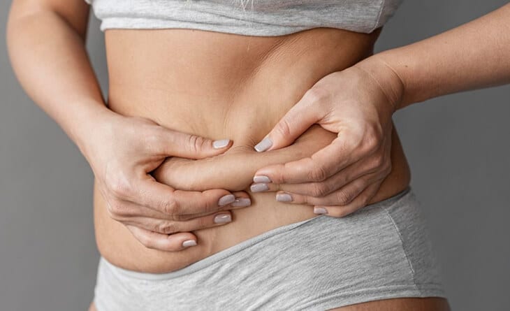 Tummy tuck procedure