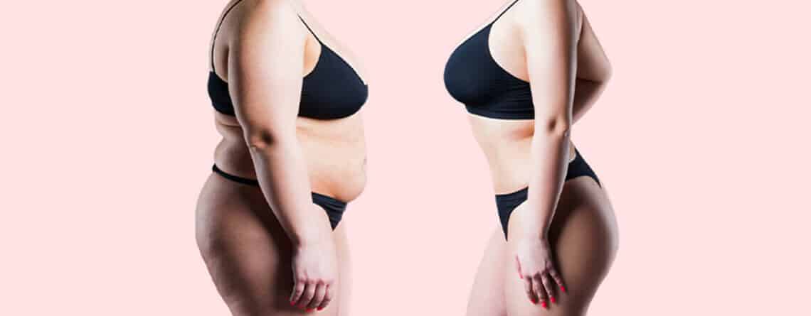 Liposuction procedure