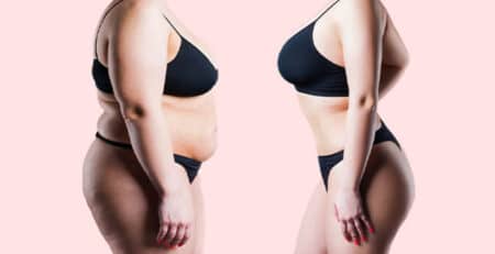 Liposuction procedure