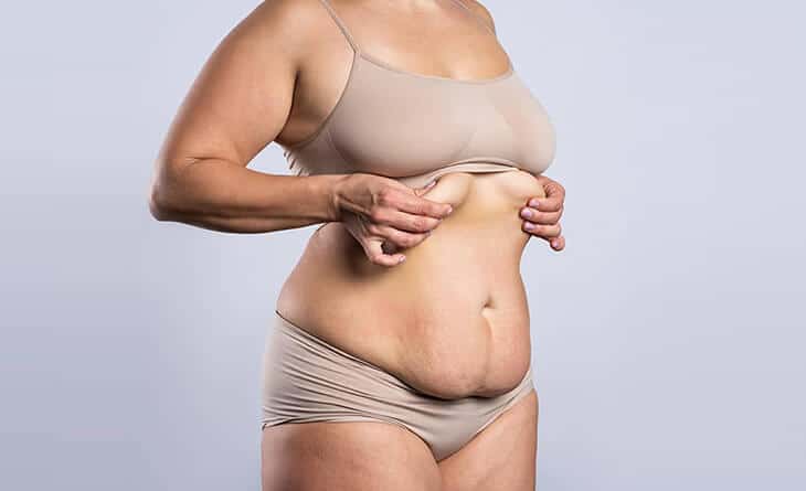 Abdominoplasty surgery in Delhi