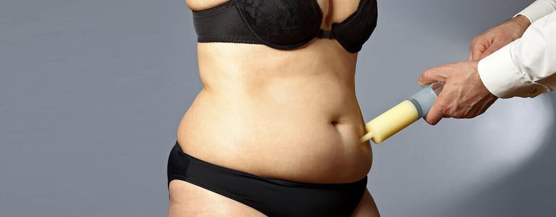Fat Removal Surgery
