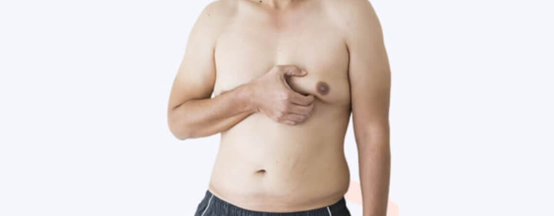 gynecomastia procedure in Delhi