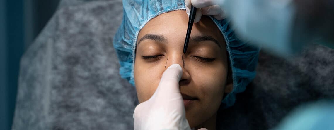 Rhinoplasty Procedure in Delhi