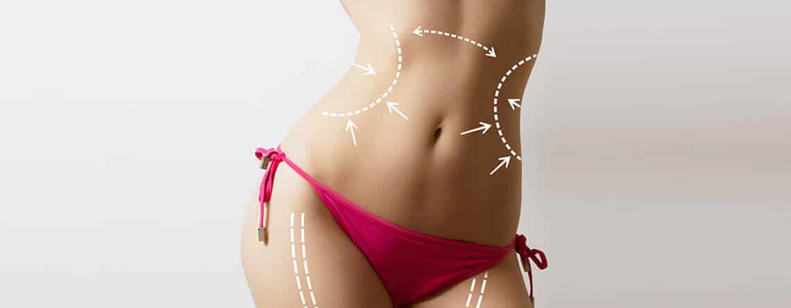 Liposuction procedure in Delhi