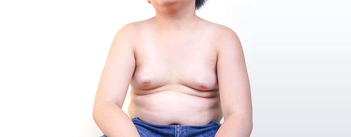 teenage gynecomastia