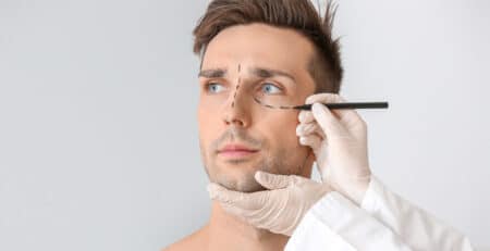 Eyelid surgery in Delhi