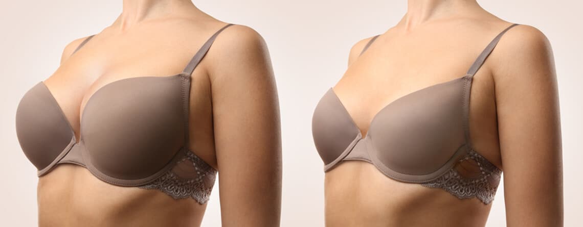 breast augmentation surgery in Delhi