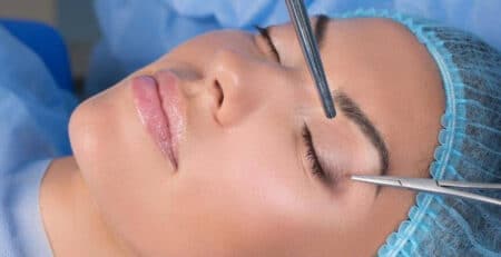Upper eyelid surgery in Delhi