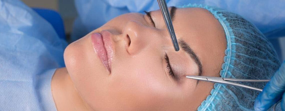 Upper eyelid surgery in Delhi