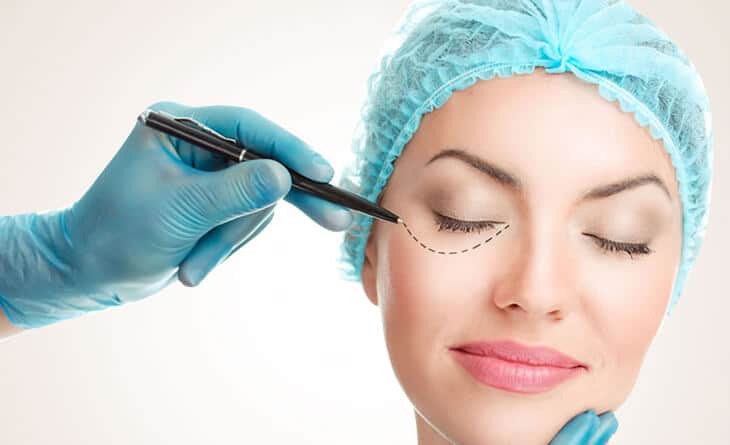 Upper eyelid surgery in Delhi