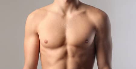 gynecomastia Surgery
