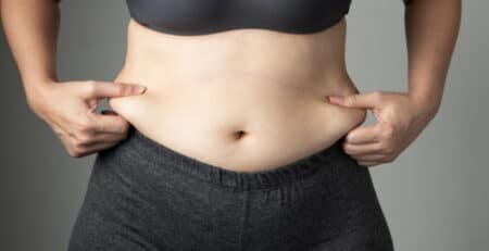 liposuction surgery