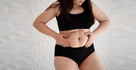 Liposuction Procedure