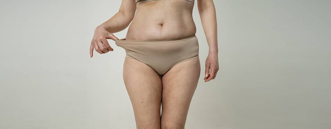 Abdominoplasty surgery