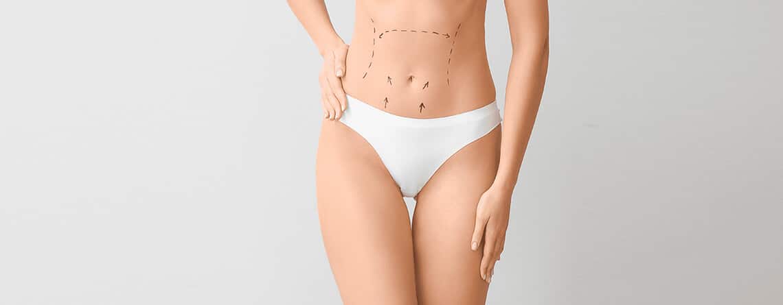 Liposuction procedure