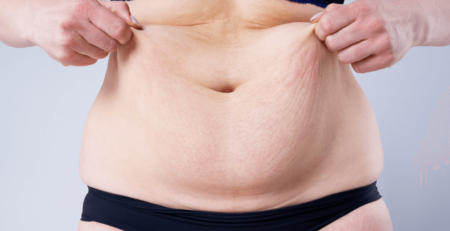 cosmetic surgery Procedure