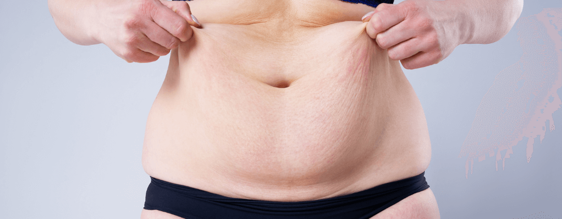 cosmetic surgery Procedure