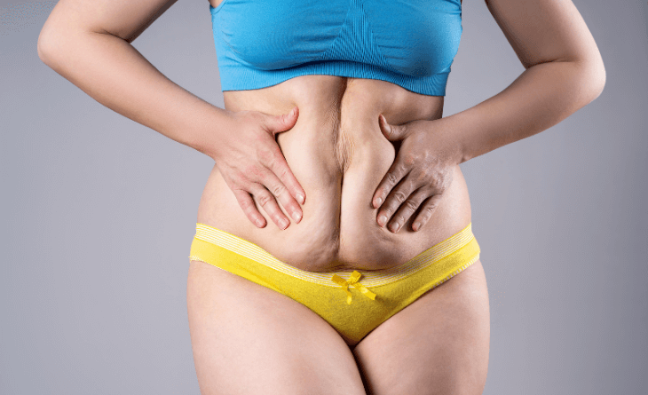 cosmetic surgery Procedure