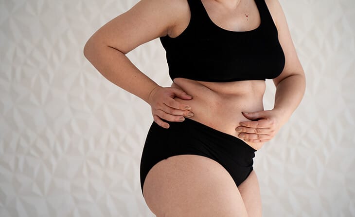 Tummy Tuck surgery