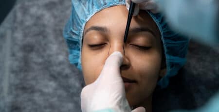 rhinoplasty surgery