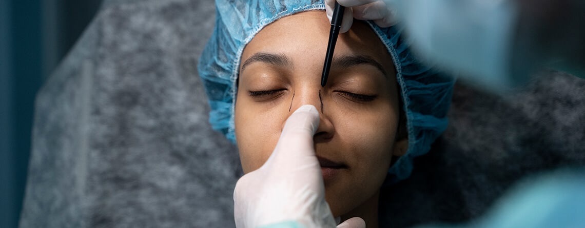 rhinoplasty surgery
