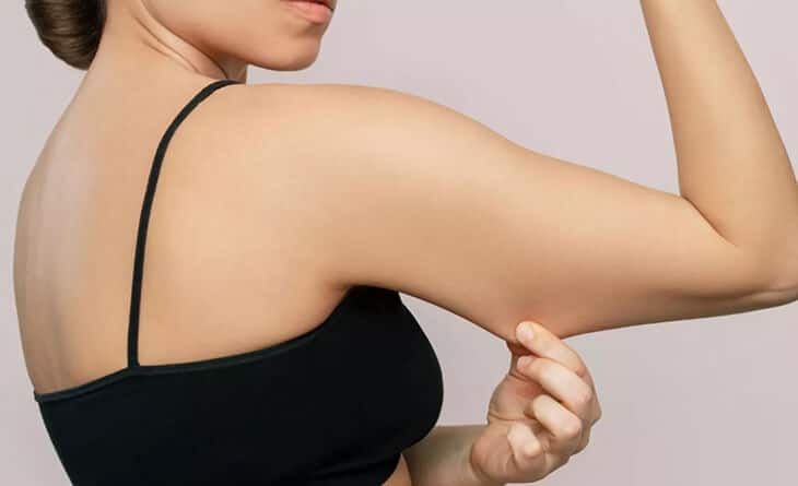 Arm Lift Surgery