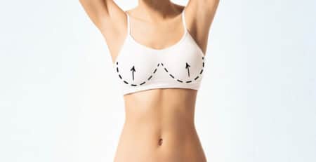 Breast augmentation surgery