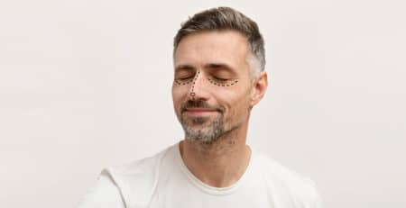 revision rhinoplasty
