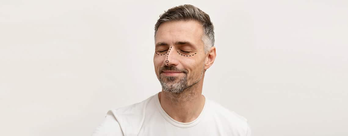 revision rhinoplasty