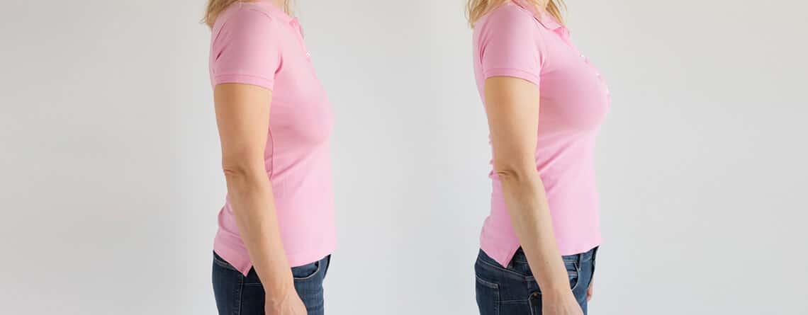 Tummy Tuck Surgery