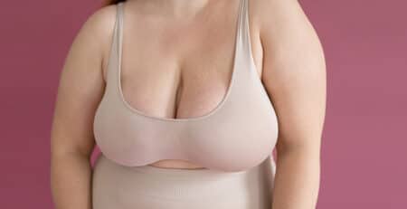 breast reduction surgery