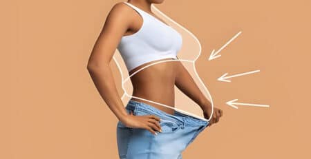 Liposuction surgery