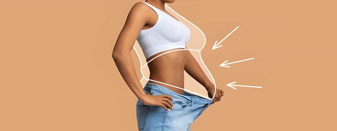 Liposuction surgery