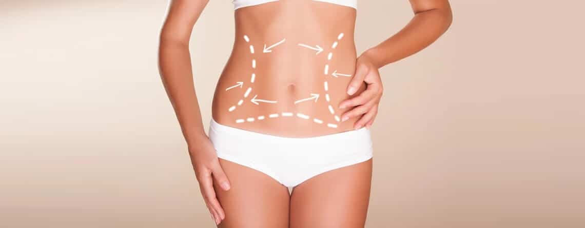 liposuction surgery