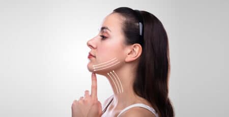 Neck Lift Surgery
