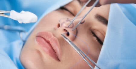 Rhinoplasty Surgery
