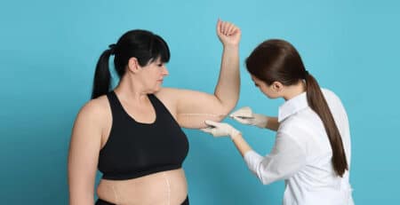 Arm Liposuction Surgery