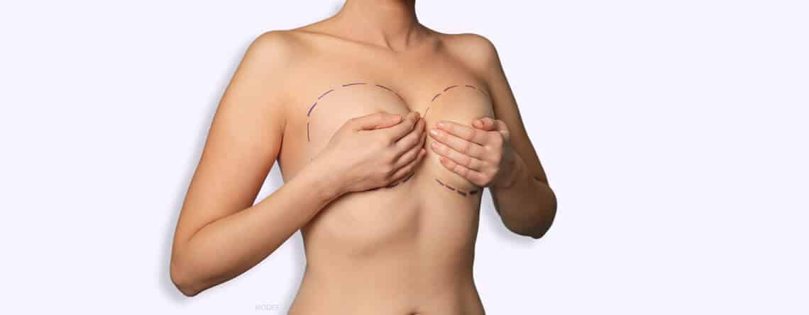 Breast Lift Surgery