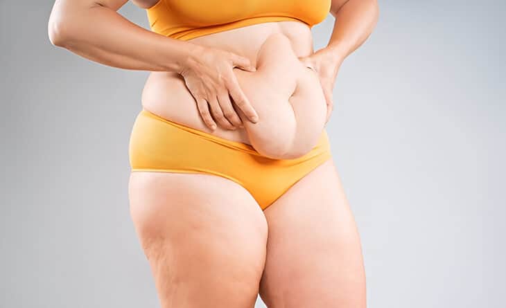 Tummy Tuck Surgery