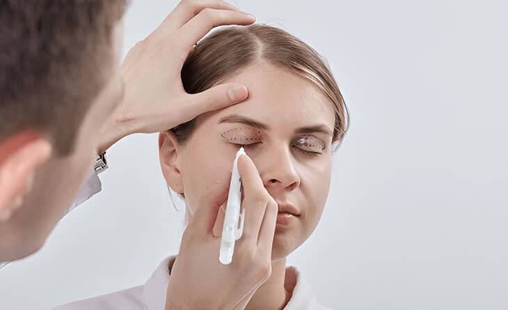 blepharoplasty procedure