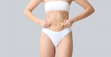 body contouring surgery