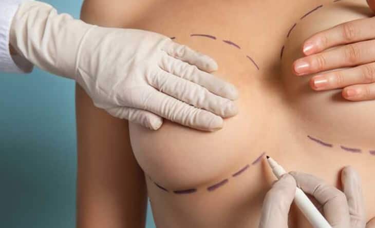 Breast reconstruction surgery