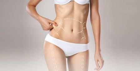 High-Definition Liposuction