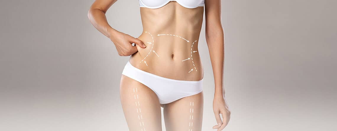 High-Definition Liposuction