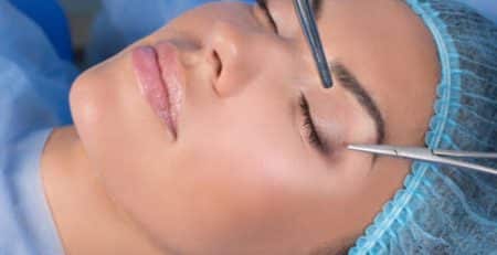 blepharoplasty surgery