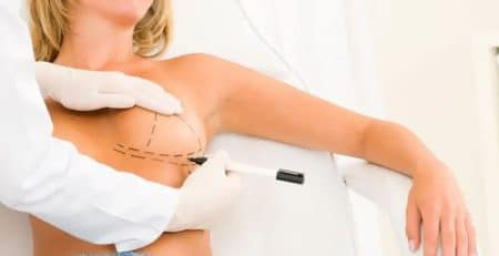 breast surgery types